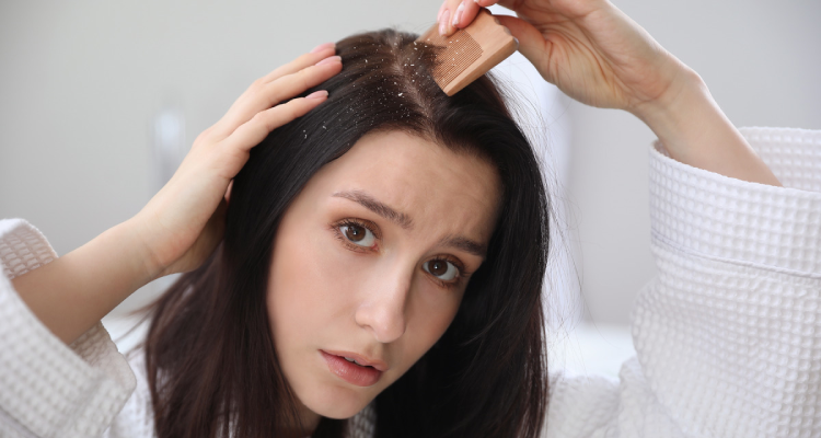Dandruff Treatment in Borivali, Mumbai at Skinzone Clinics