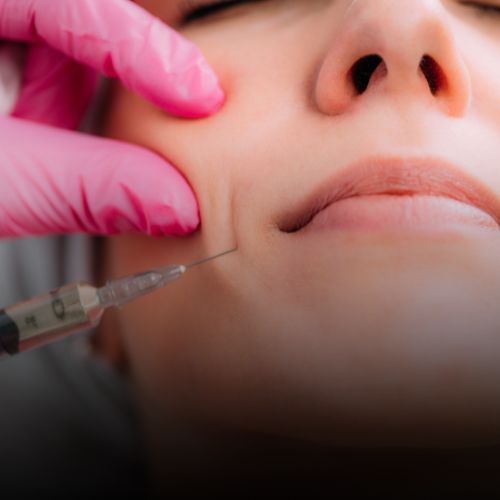Derma Fillers Treatment in Borivali at Skinzone Clinics