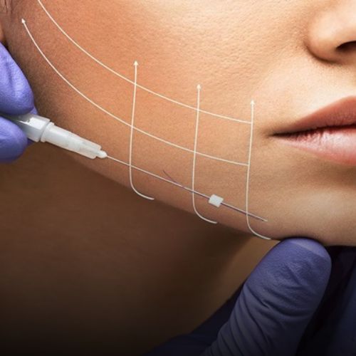 Facelift Treatment in Borivali, Mumbai at Skinzone Clinics