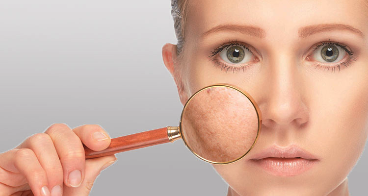 Laser Pigmentation Treatment in Borivali, Mumbai at Skinzone Clinics