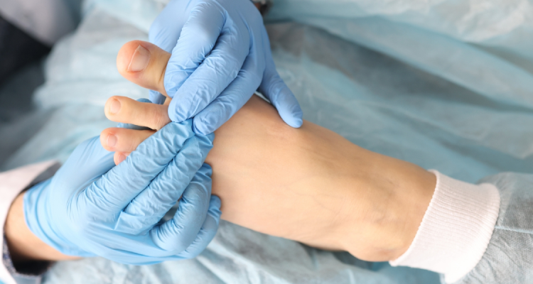 Nails Treatments in Borivali, Mumbai at Skinzone Clinics